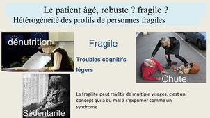 Fragilité concept anesthésie de la personne âgée
