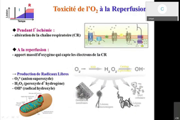 Ischémie Reperfusion Et Protection Myocardique Non Cardioplégique P Chiari-1.m4v