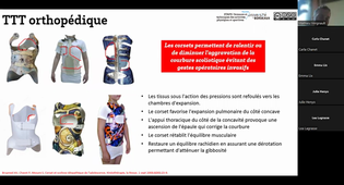 CM5 - Pathologies de l'appareil locomoteur - L2 STAPS mention APA-S