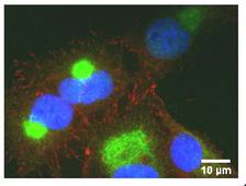 Cours 1 (Imagerie - Microscopie de Fluorescence)
