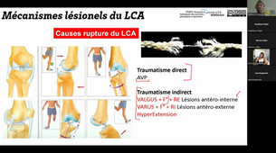 CM1 - Pathologies de l'appareil locomoteur - L2 STAPS mention APA-S