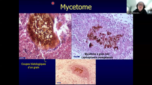 Mycologie Tropicale - Partie 2 Pr Delhaes.mp4